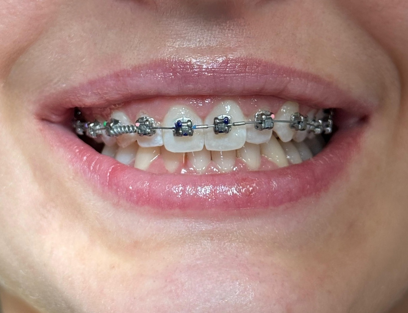 <span style="font-weight: bold;">ортодонтия </span>