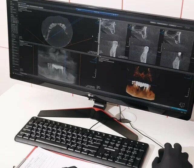 <span style="font-weight: bold;">Имплантация </span>